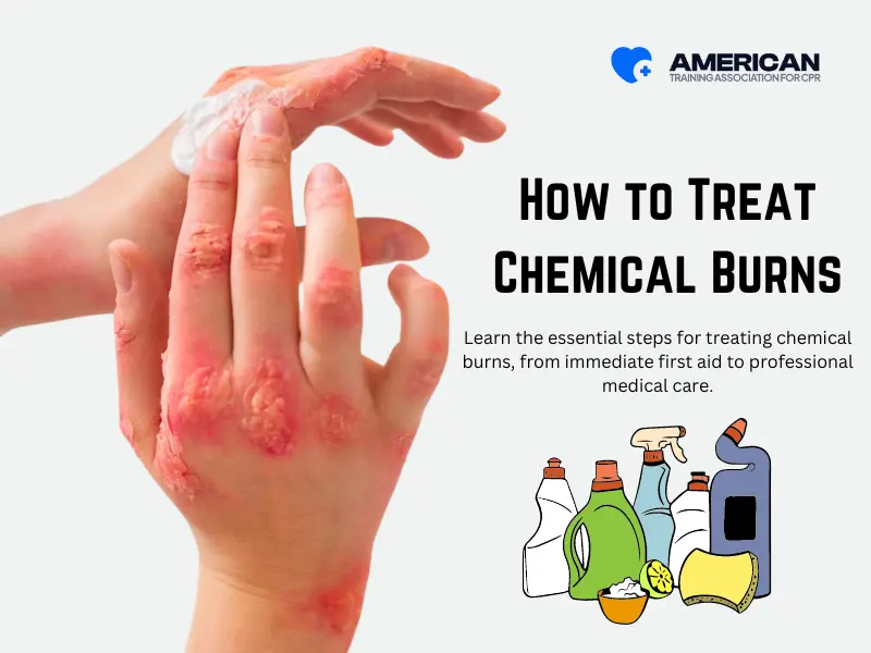 Which Of The Following Statements Is True About Burn Treatment How to Treat Chemical Burns: First Aid Essentials